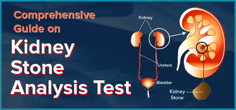 Comprehensive Guide on Kidney Stone Analysis Test